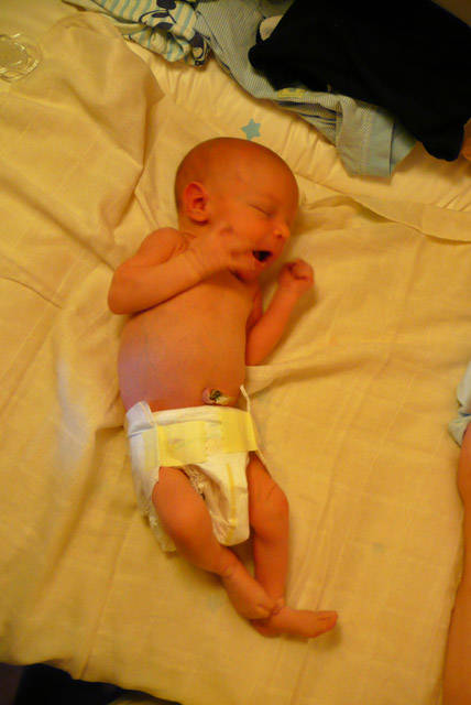 Florian Tag 8 als kleiner Nacktspatz